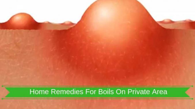 Home-Remedies-For-Boils-On-Private-Area