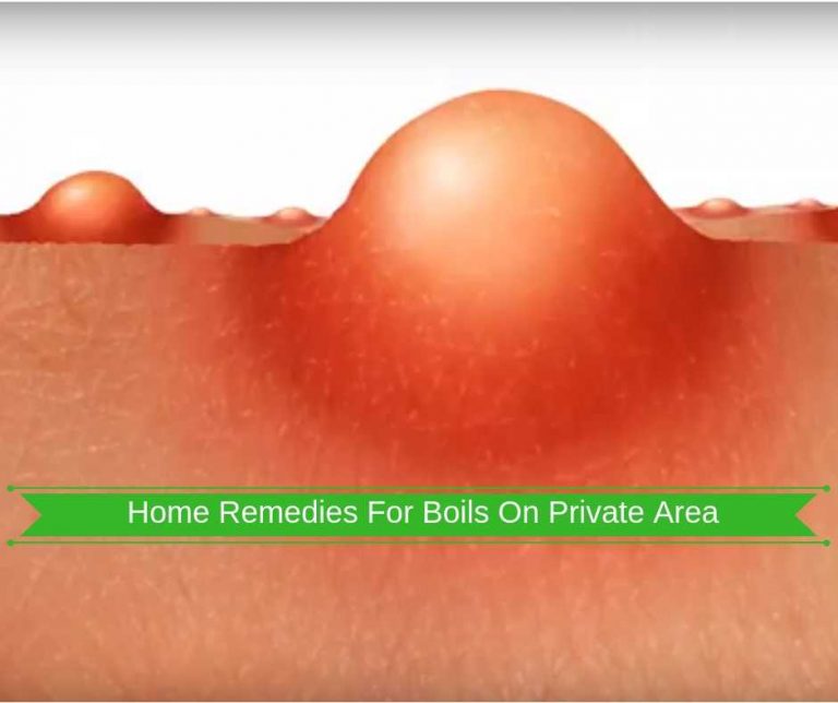 home remedies for boils on private area